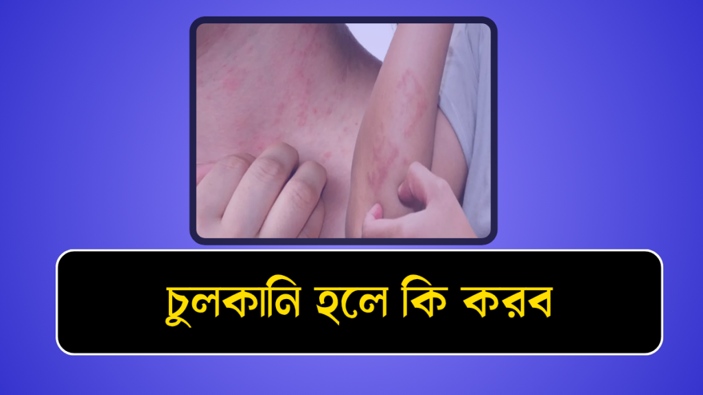চুলকানি হলে কি করব | culkani hole ki korbo, জীবন নিয়ে ক্যাপশন